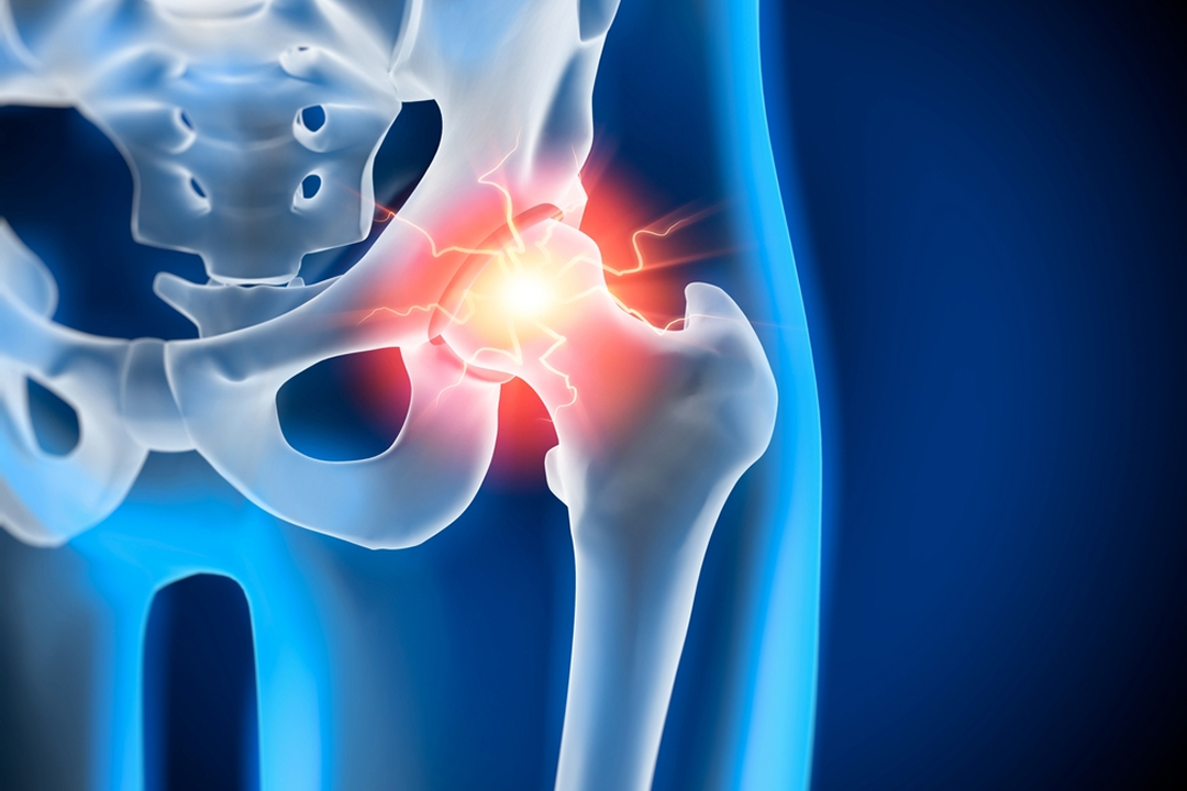 knee replacement surgery nashik